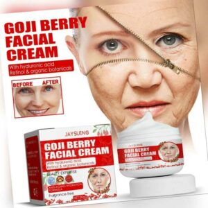 30g Goji-Beeren-Gesichtscreme Hautregeneration Anti-Falten O6D9